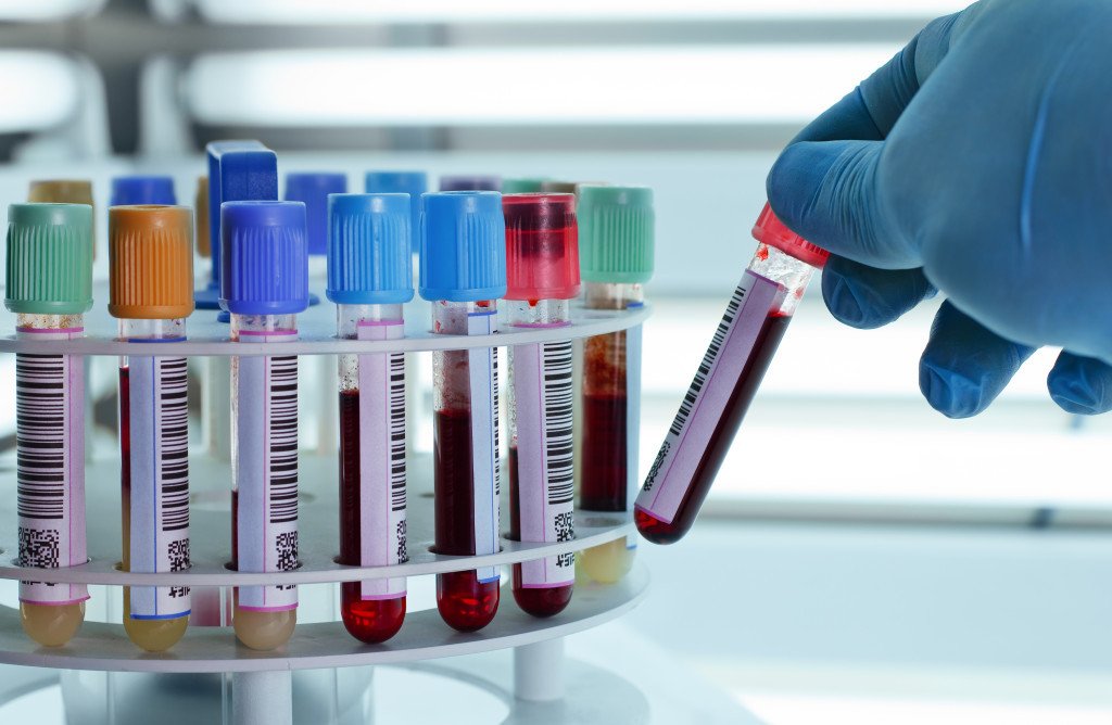 The Biohacker's Guide to Blood Work